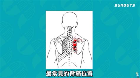 頭背|背部痠痛難耐！解開6處背痛位置與身體連結警訊，由。